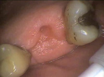 Rob1 kuz2zs - Eugenol