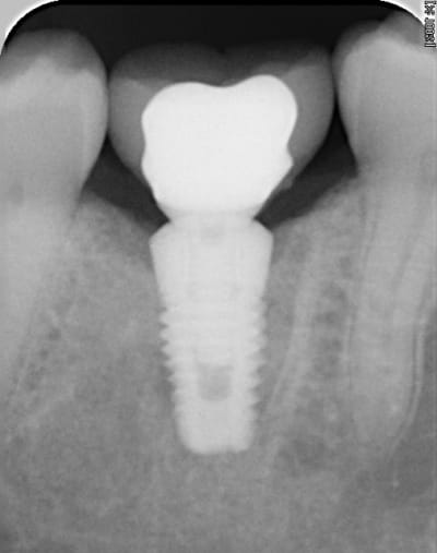 Rvg easy briwxo - Eugenol