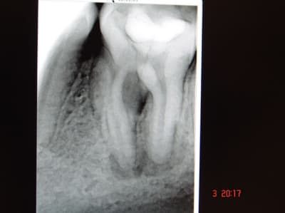 Rx1 omp38z - Eugenol
