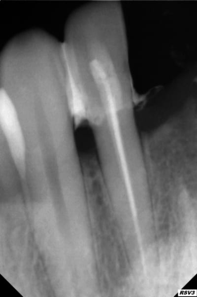 Rx2 vsdeg2 - Eugenol