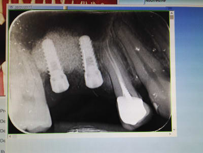 S6xnsimdzbkup55h4qhm - Eugenol