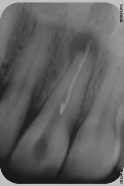 Sana1 dudygp - Eugenol