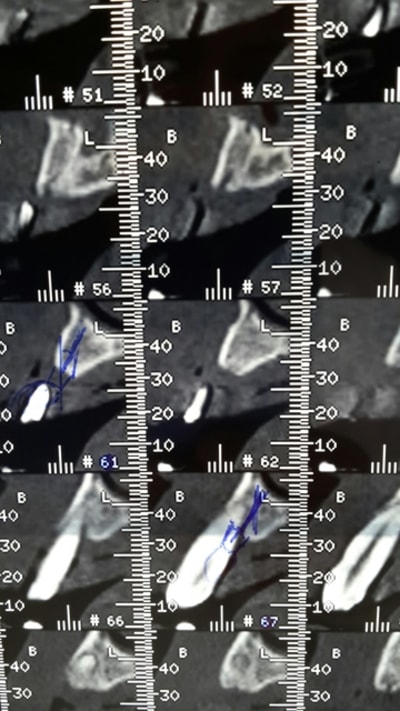 Scan1 p02gyp - Eugenol