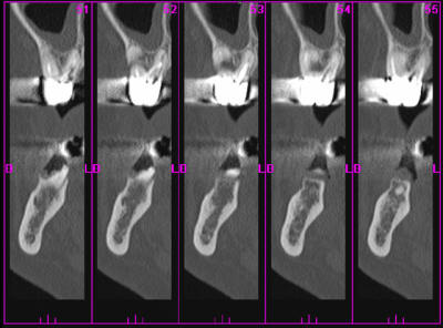 Scan2 yo6rvy - Eugenol