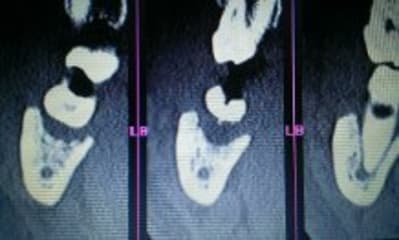 Scan3 en4ioy - Eugenol