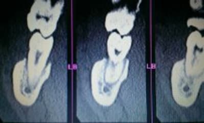 Scan4 qghc9t - Eugenol