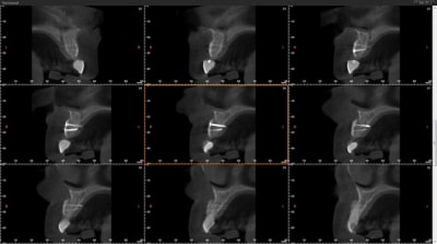 Scan 2 mois hbmmqp - Eugenol