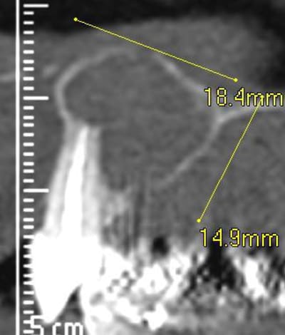 Scan profill en 11 pjuseg - Eugenol