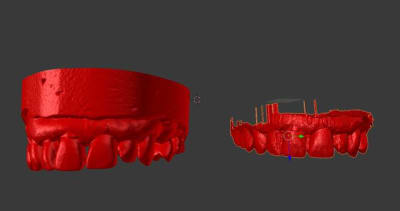 Scan vs cam3d qxzdnw - Eugenol