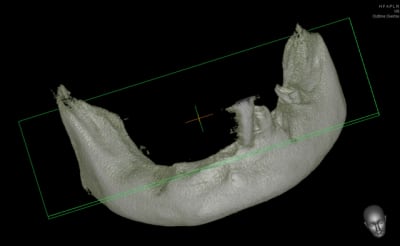 Scancbct bcwcut - Eugenol