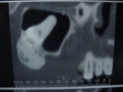 Scanner 001 jl2xh6 - Eugenol