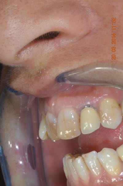 Scaringella 1  4  qwoufu - Eugenol