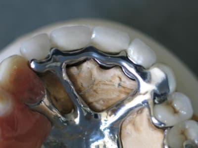 Selle disjointe 2 csddem - Eugenol