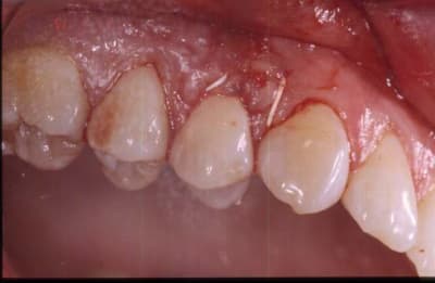 Site j 0 t4ls8y - Eugenol