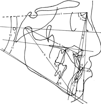 Sna snbnegatif bx6bib - Eugenol