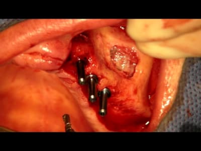 Snapshot cgakrz - Eugenol