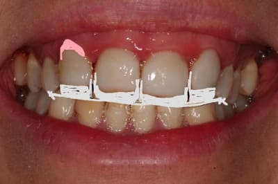 Sourir vhp6yf - Eugenol