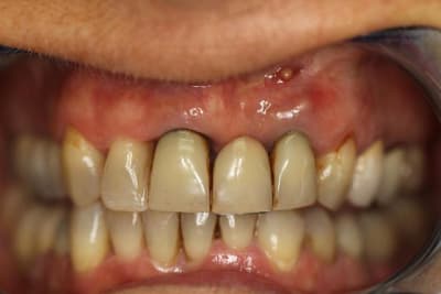 Sourire  2  tvm1kr - Eugenol