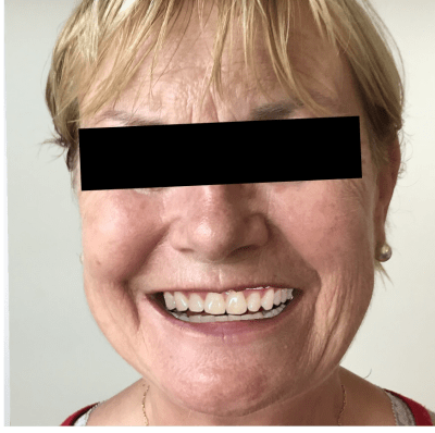 Sourire de simone un peu mieux wakjbo - Eugenol