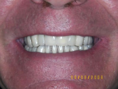 Sourire o8xzm3 - Eugenol