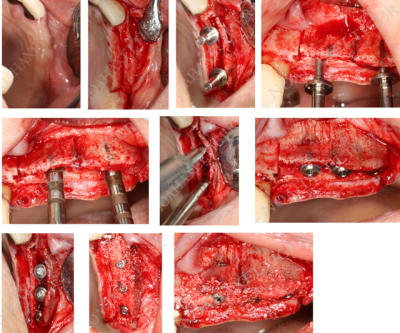 Splitting hawmjg - Eugenol