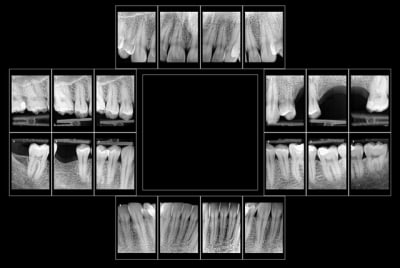 Statutjulien bkmron - Eugenol
