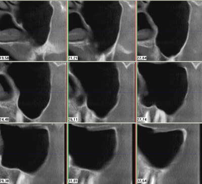 Suns gauche xjetp9 - Eugenol