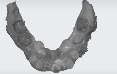 Sxivdrphiosuycm7x4u6 - Eugenol