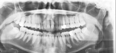 T55vqkpypsjmhzc5vut7 - Eugenol