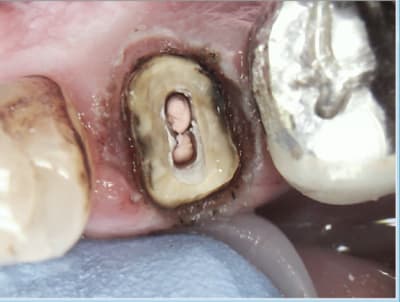 T8oafimbrxl6a89o3zwa - Eugenol