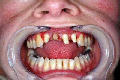 Tailles vhndiy - Eugenol