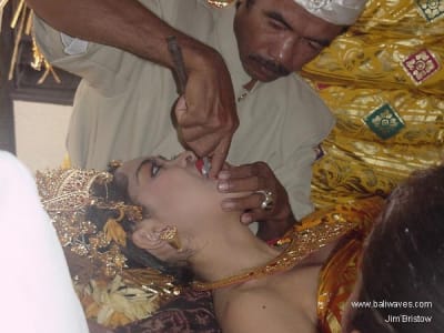 Teeth6 g64zpc - Eugenol