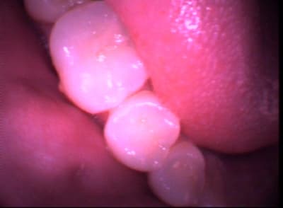 Test2 vbonao - Eugenol