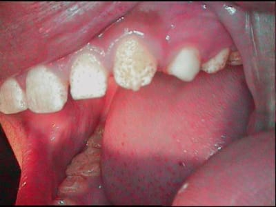 Test prealable sur 24 vv6qwp - Eugenol
