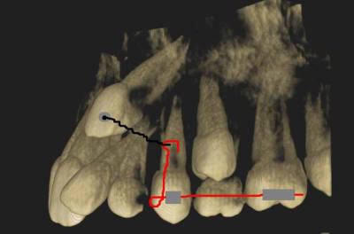 Traction canine ge5ayk - Eugenol