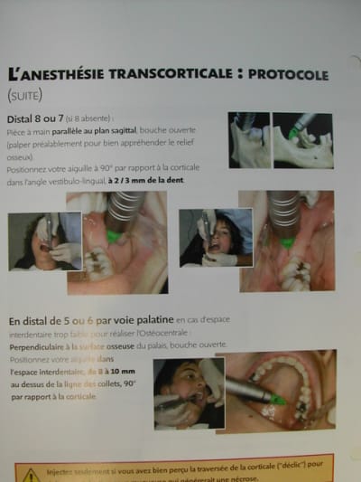 Transcort s2pv4i - Eugenol