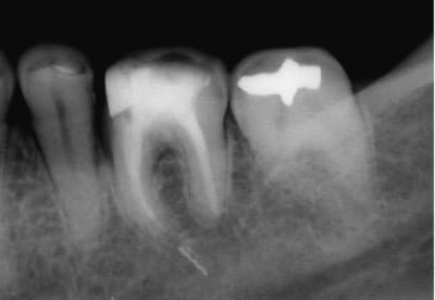 Trop loin gs4teo - Eugenol