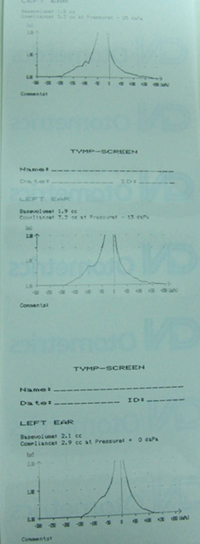 Tymp3 fztkj6 - Eugenol