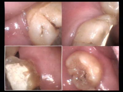 Un cas difficile paro à 90 jours 3 vqjxqq - Eugenol