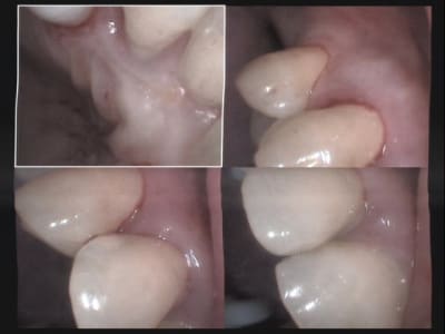 Un cas difficile paro le 1er jour 1 uglywk - Eugenol