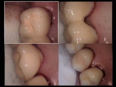 Un cas difficile vue rapprochée haut droit presque fini 2 fq2pe7 - Eugenol