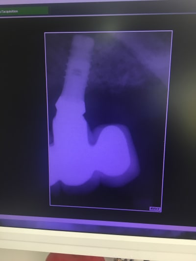 Unudoxtsl9cait4qj9ue - Eugenol