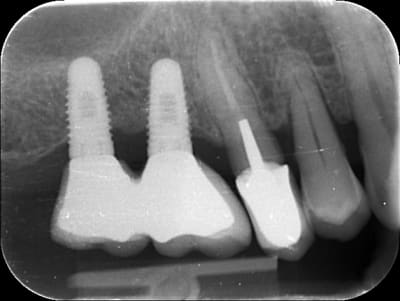 V0mcmib8haxmwus9h1ix - Eugenol