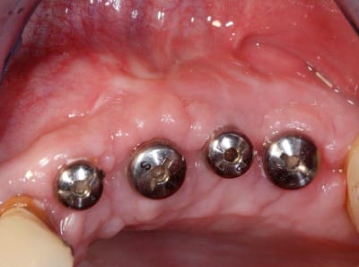 Vis cicat m6hyqf - Eugenol