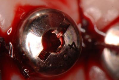 Vis cicat vncip0 - Eugenol