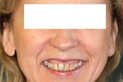 Visage svxotk - Eugenol