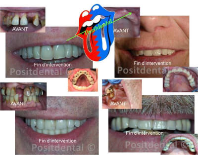 Voyage adf 2 gwtpto - Eugenol