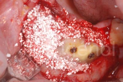 Vue2 vaiy7d - Eugenol