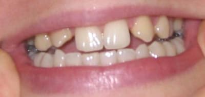 Vue ensemble phctkt - Eugenol