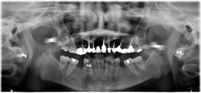 Vxxhq1ufdy4j76gnq7gm - Eugenol